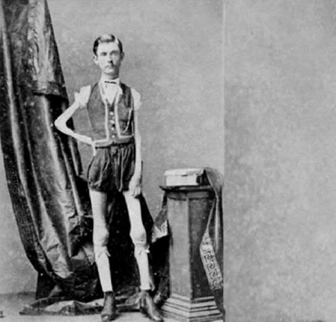 15 Personagens De Circo Que Realmente Existiram